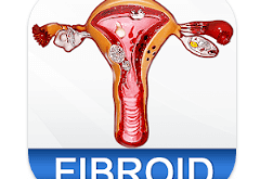 Download Uterine Fibroid Treatment Help MOD APK